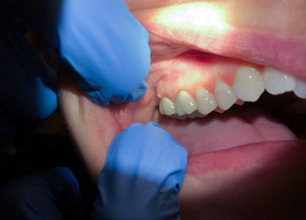 Best Pediatric Emergency Dentist in Ferrum, VA