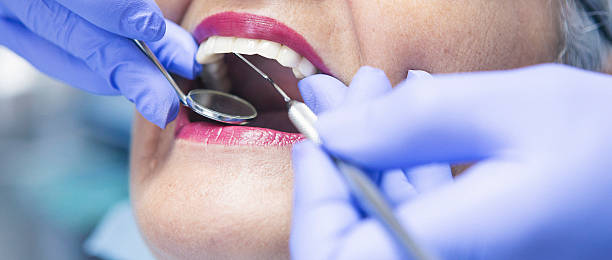 Best Emergency Wisdom Teeth Removal in Ferrum, VA